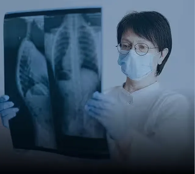 Doctor reviewing a chest x-ray